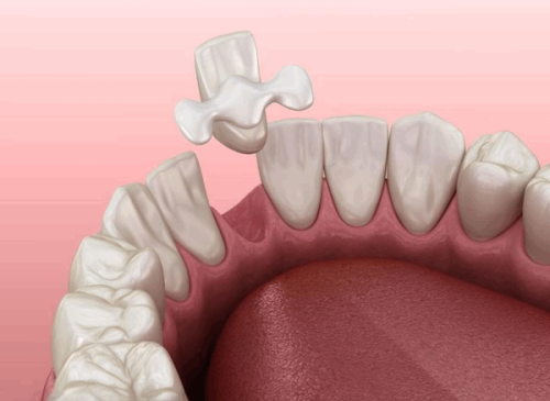贵州安顺牙博仕口腔门诊部真人口碑评价怎么样？