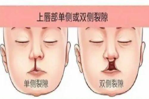 佛山沐晨医疗美容门诊部地址电话营业时间