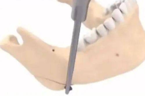 戴浩医生口碑评价及真人实例