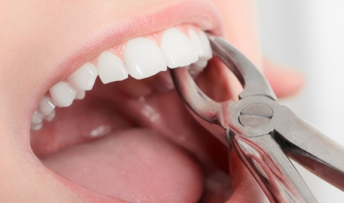 山东德州禹城爱华口腔地址电话营业时间