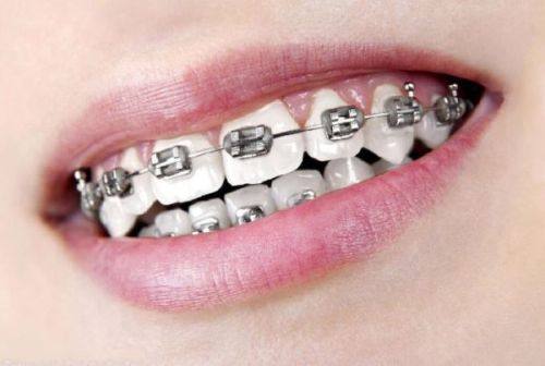 兰晓莉医生预约挂号