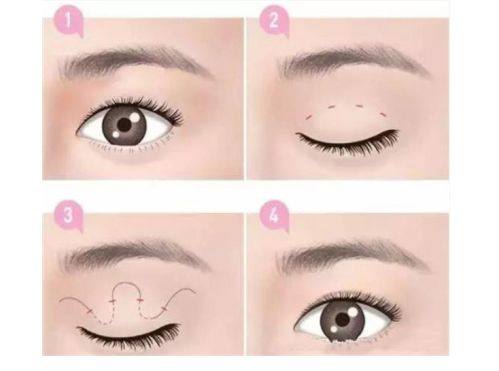 白色美龄时光医疗美容门诊部特色项目及技术优势