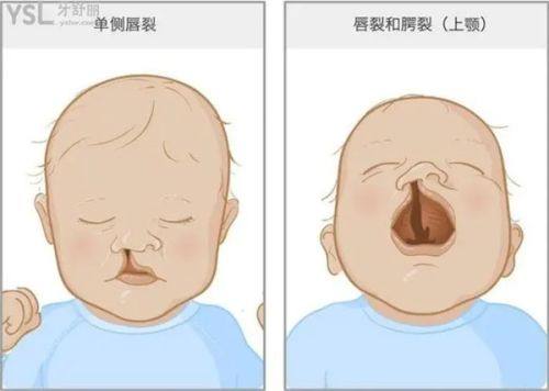 佛山沐晨医疗美容门诊部真人口碑评价怎么样?