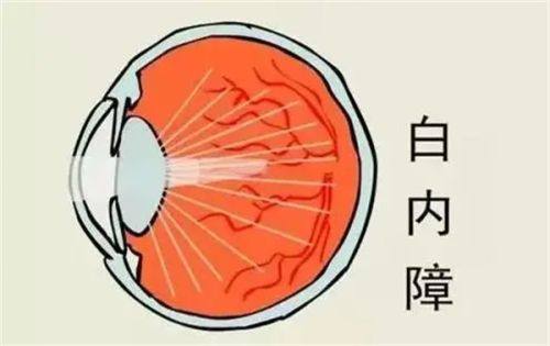 乳山新视力眼科医院收费价格表/收费标准
