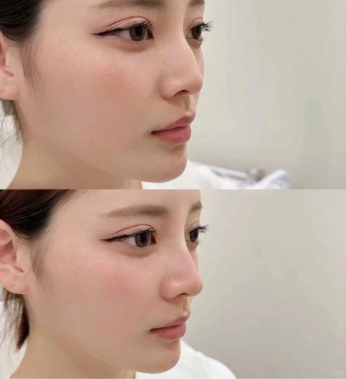 杭州亿咖整形医院收费价格表/收费标准