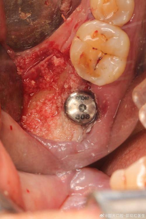 口碑评价及真人实例