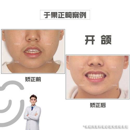 蚌埠名仁口腔门诊真人口碑评价怎么样？