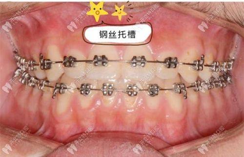 侯露医生技术优势