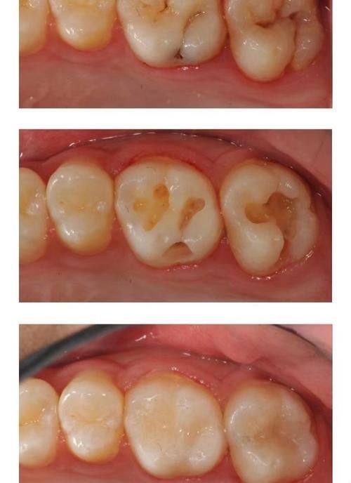 西宁市城东区铭佳口腔特色项目及技术优势