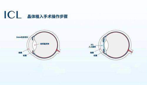 松原润明眼科医院