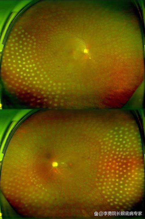 乳山新视力眼科医院地址电话营业时间