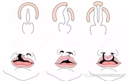 佛山沐晨医疗美容门诊部详细的预约挂号方式及流程