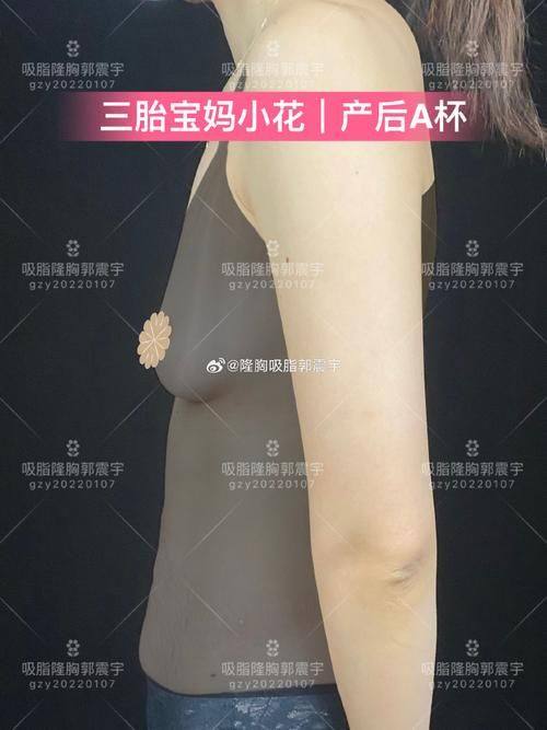 库尔勒翟玲玲医疗美容诊所真人口碑评价怎么样?