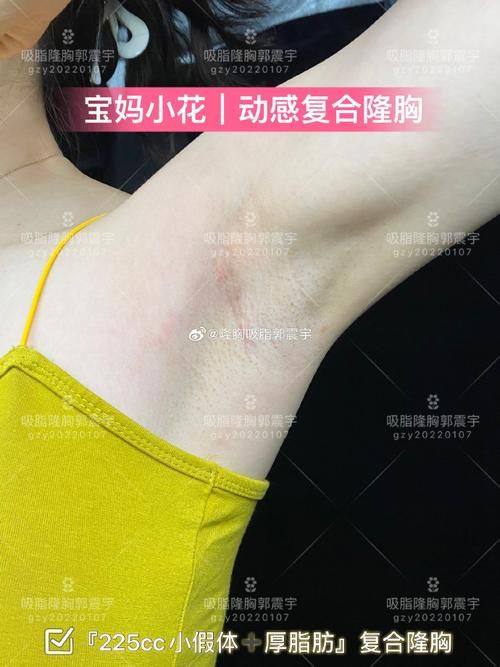 莆田永秀整形医院真人口碑评价怎么样？