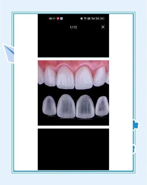 安徽安庆华棋口腔特色项目及技术优势