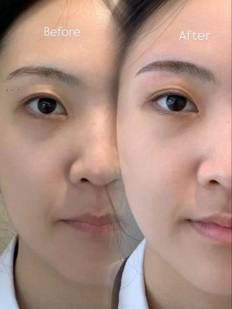 济南步步莲盛医疗美容诊所真人口碑评价怎么样？