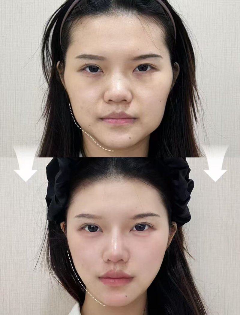 李斗荣医生价格表