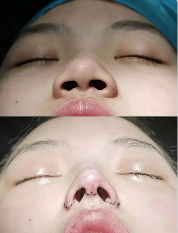 戴浩医生技术优势