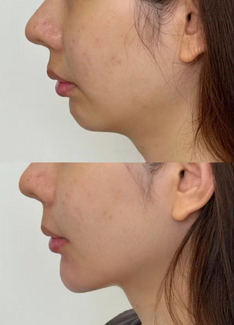 济南步步莲盛医疗美容诊所详细的预约挂号方式及流程