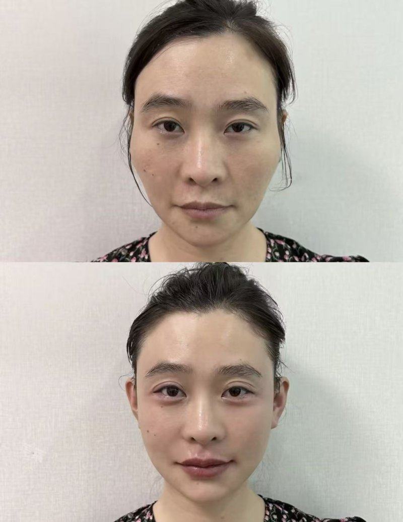 济南步步莲盛医疗美容诊所特色项目及技术优势