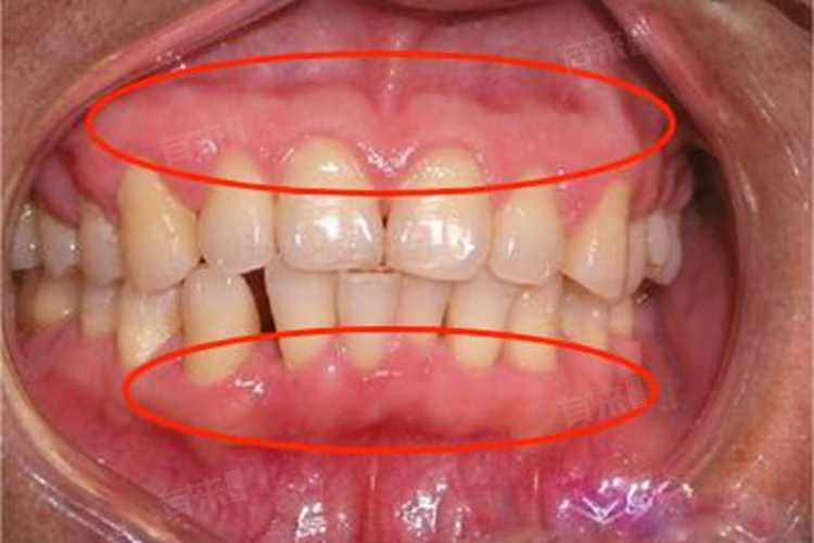 兰晓莉医生口碑评价及真人实例