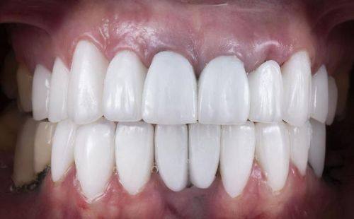 亳州严秀口腔诊所详细的预约挂号方式及流程