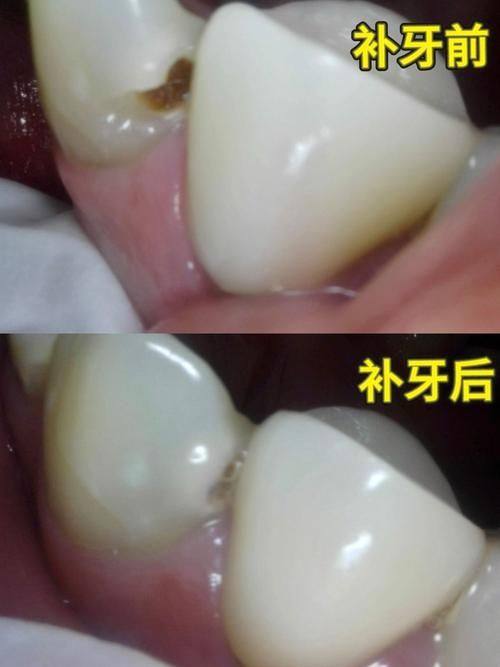 江苏常州爱齐博口腔收费价格表/收费标准