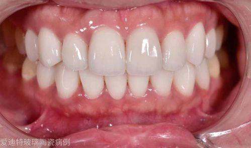 亳州严秀口腔诊所真人口碑评价怎么样？