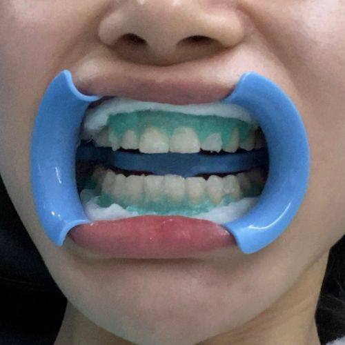 湖南益阳沅江曹医师口腔真人口碑评价怎么样?