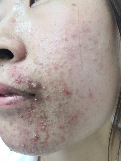 杨海江医生口碑评价及真人实例