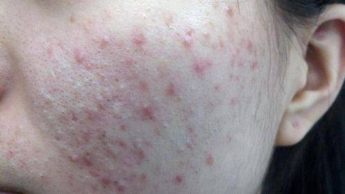 杨海江医生预约挂号