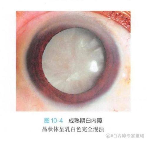 彭州市人民医院眼科真人口碑评价怎么样？