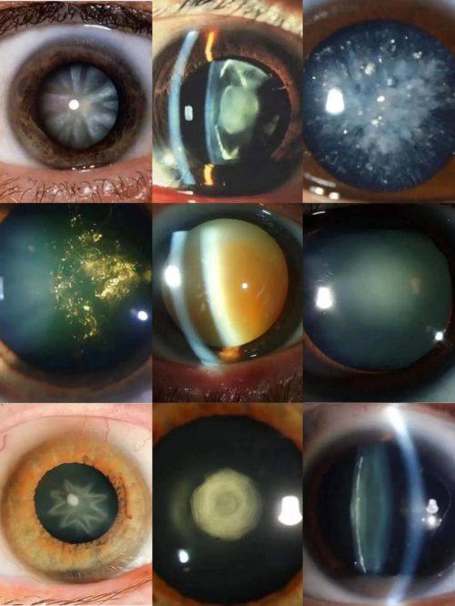 东莞光明眼科医院特色项目及技术优势