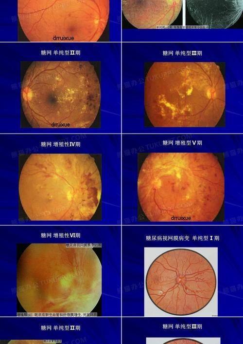 东莞光明眼科医院真人口碑评价怎么样？