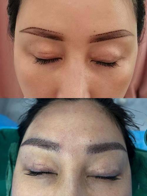 长春市至美医疗美容门诊部收费价格表/收费标准