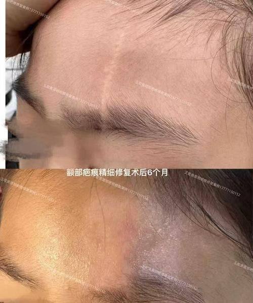 长春市至美医疗美容门诊部详细的预约挂号方式及流程