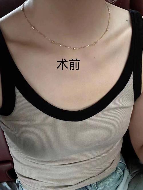 长春市至美医疗美容门诊部真人口碑评价怎么样?