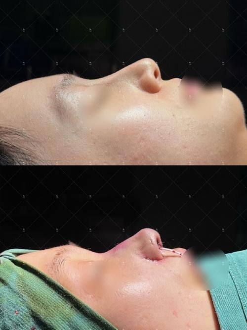 桂林医学校第二附属医院整形美容科真人口碑评价怎么样？