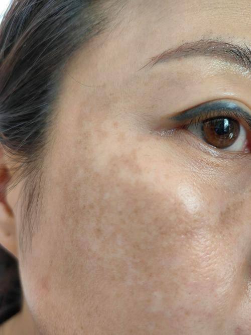 杨海江医生技术优势