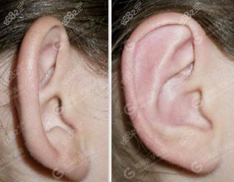 韩国江南Stardom整形医院详细的预约挂号方式及流程