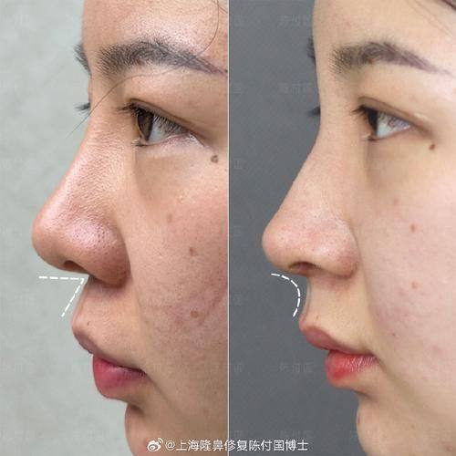 赣州市人民医院烧伤整形科医生团队实力强大及骨干医生简介