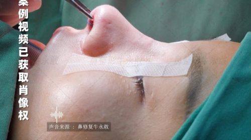 赣州市人民医院烧伤整形科特色项目及技术优势