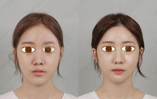 八王子Skin Care收费价格表/收费标准