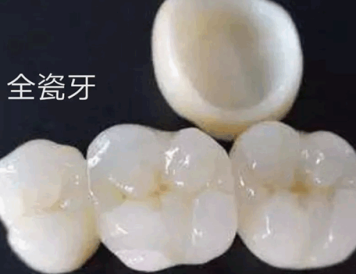 厦门亚欧口腔门诊部收费价格表/收费标准