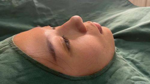 烟台百黛刘芳医疗美容门诊部特色项目及技术优势