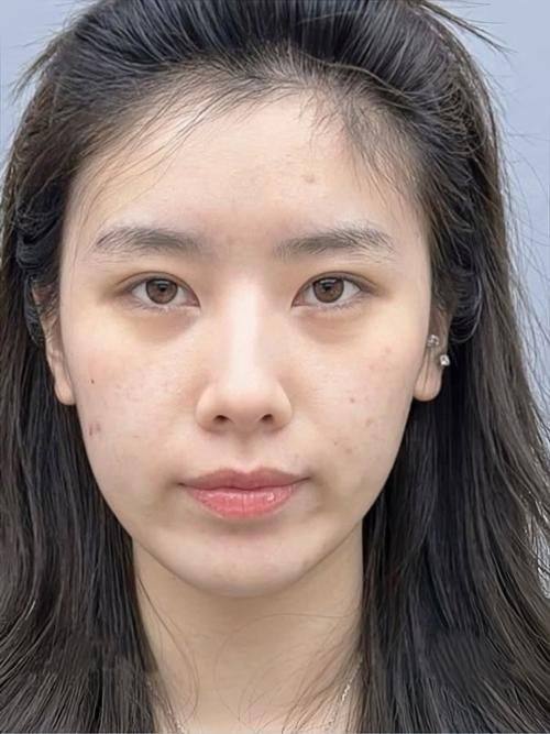 济宁星氧医疗美容门诊部收费价格表/收费标准