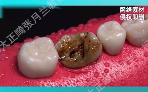 严秀医生擅长项目