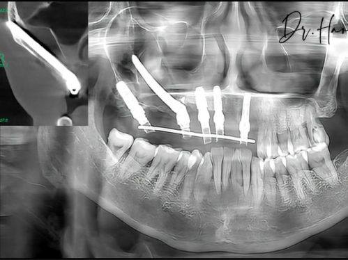 侯露医生擅长项目