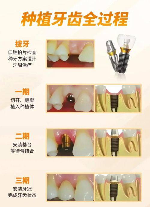 侯露医生口碑评价及真人实例