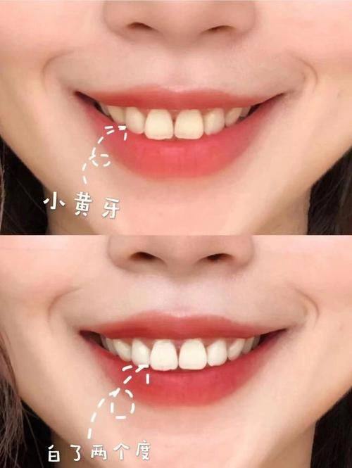 厦门亚欧口腔门诊部特色项目及技术优势